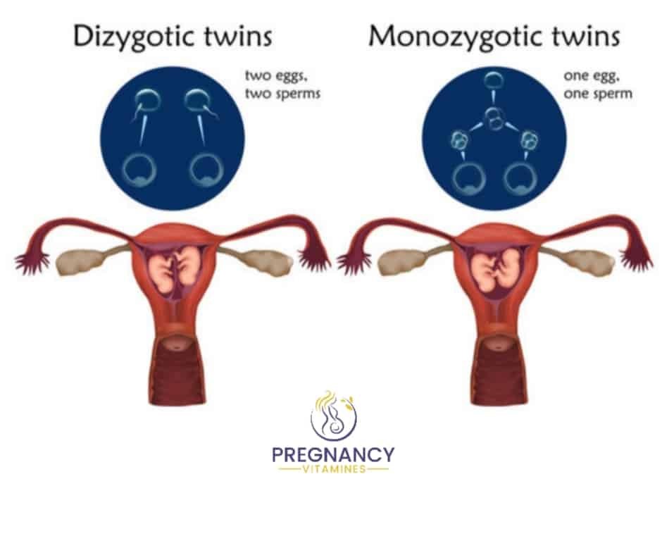 Multiple pregnancy-multiple pregnancies