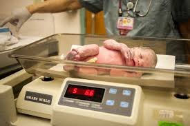 Low birth weight nursing management