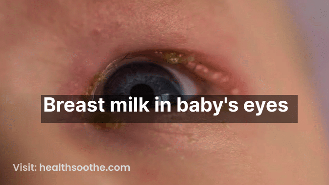 Breast milk in baby's eyes