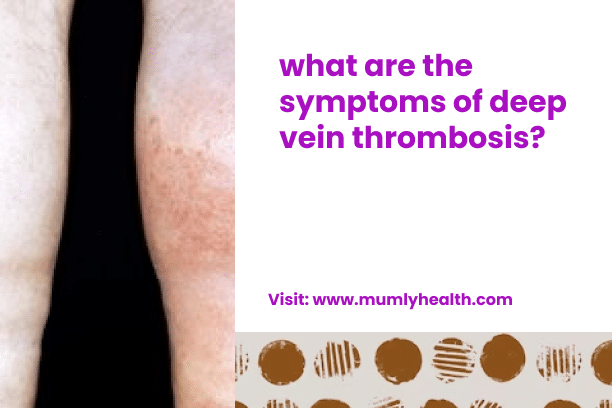 what are the symptoms of deep vein thrombosis_